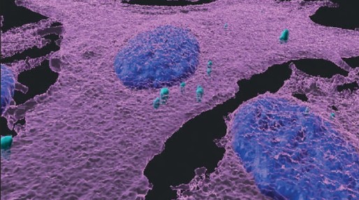 Descoperire semnificativă: melanomul paralizează celulele imune care îl atacă