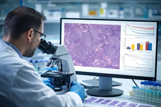 Limfomul folicular poate fi vindecat, sugerează datele unui studiu pe 15 ani