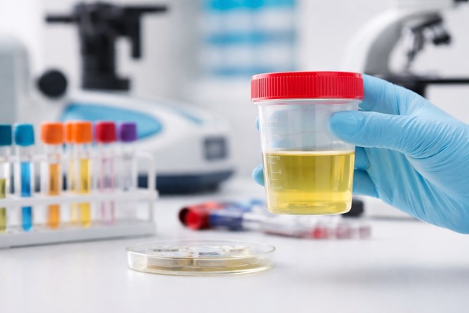 Biopsia lichidă din urină ar putea ghida tratamentul personalizat în cancerul vezicii urinare